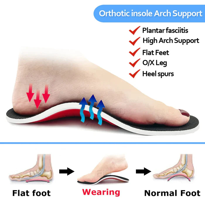 ReliefSole™ Flat Foot Correction Pain Relief Insoles - 1 Pair