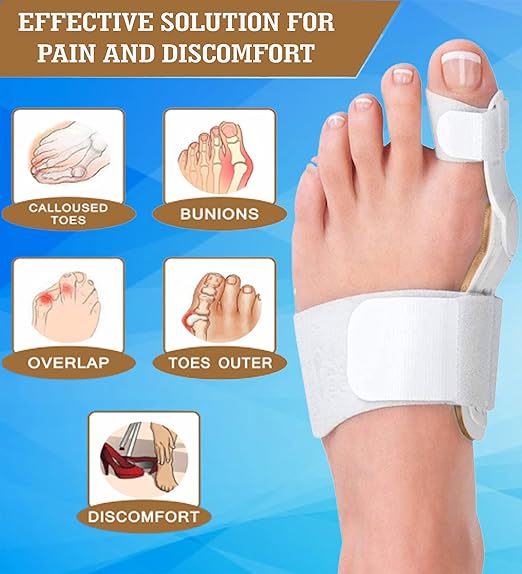 3D Bunion Splint Corrector