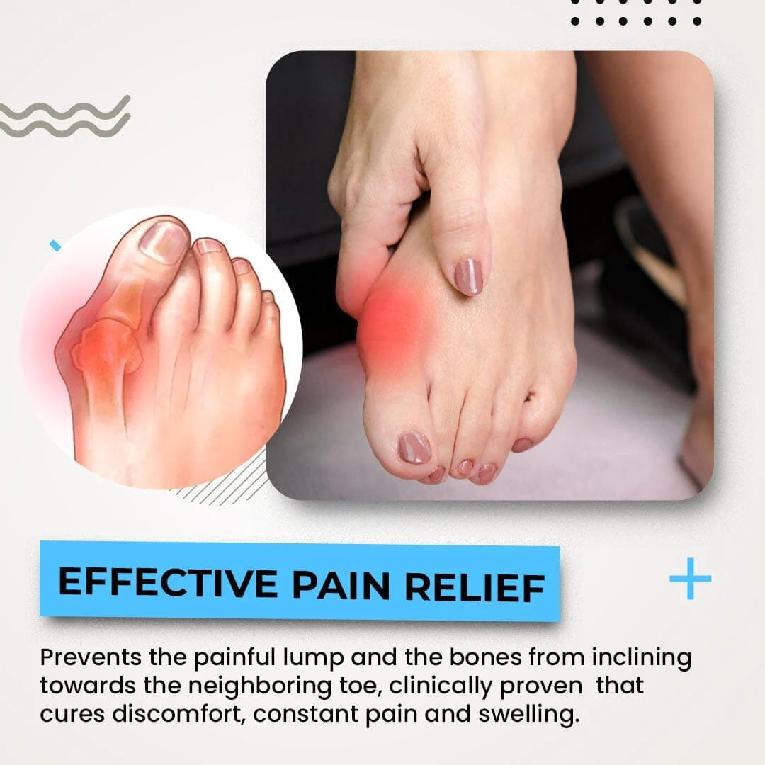 3D Bunion Splint Corrector